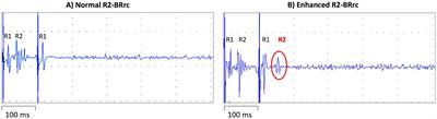 Simple biomarkers to distinguish Parkinson’s disease from its mimics in clinical practice: a comprehensive review and future directions